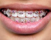 ORTHODONTIST with kbmdental in Rathfarnham