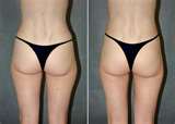 Hips and bums enlargement cream