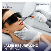 Laser resurfacing in Cork – the secret to a youthful appearance!