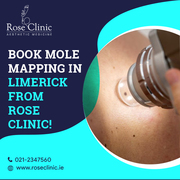 Detect Melanoma Early With Mole Checks In Limerick 