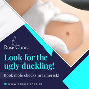  Look for the ugly duckling! Book mole checks in Limerick!