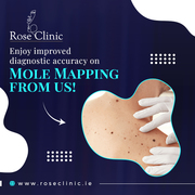 Unerring accuracy in mole check in Ireland from Rose Clinic.