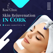 What You Need to Know About Skin Rejuvenation in Cork?