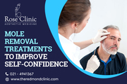 Boost Your Appearance And Confidence With Mole Removal