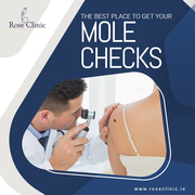 The Best Place To Get Your Mole Checks in Limerick - The Rose Clinic 